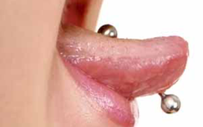 Piercing linguale: conseguenze per gengive e impianti