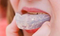 Il paradenti a protezione contro i traumi della bocca e dei denti quando si praticano sport di contatto
