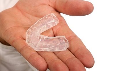 Bite: quando è utile?